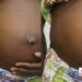 Teenage Pregnancy in Ghana