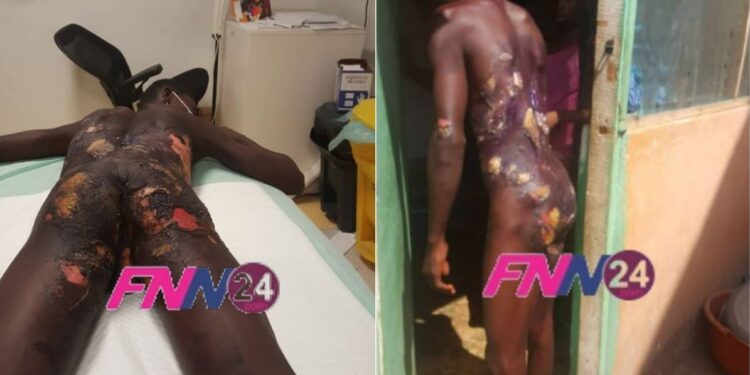 woman pours hot water on son's body
